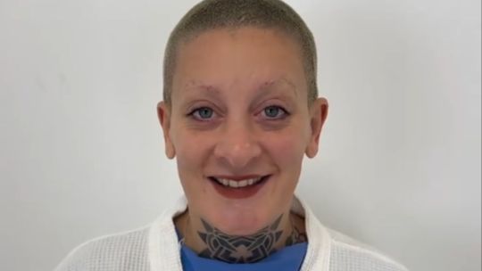 Furia se operó la nariz y el equipo de Gossip opinó sobre la cirugía: Cómo le quedó la napia?