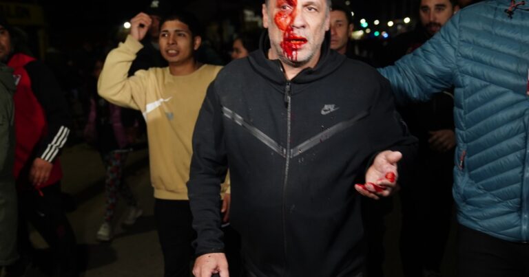 Habló Cristian Mercatante, el cronista herido en el cierre de campaña de Milei: «Este impacto a un nene lo mata»